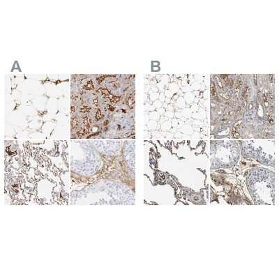 Immunohistochemistry-Paraffin: Complement C3 Antibody [NBP1-85493]