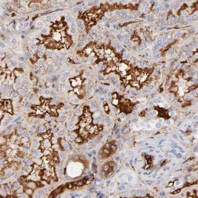 Immunohistochemistry-Paraffin: Complement C3 Antibody [NBP1-85493]