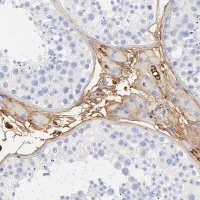 Immunohistochemistry-Paraffin: Complement C3 Antibody [NBP1-85493]
