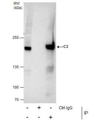 Immunoprecipitation: Complement C3 Antibody [NBP1-32080]