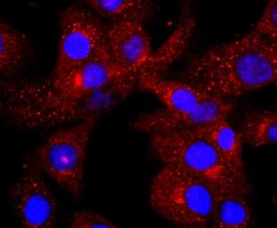 Immunocytochemistry/ Immunofluorescence: Complement C3 Antibody (JF10-30) [NBP2-66994]