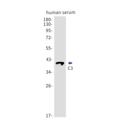 Western Blot: Complement C3 Antibody (S06-2C2) [NBP3-19586]