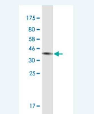 Western Blot: Complement C3 Antibody (X1) [H00000718-M11-100ug]