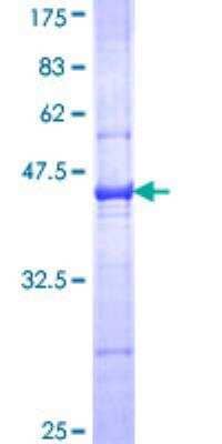 SDS-PAGE: Recombinant Human Complement C3 GST (N-Term) Protein [H00000718-Q01]