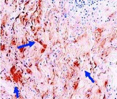 Immunohistochemistry-Frozen: Complement C3c Antibody (10-02A) - BSA Free [NB100-64339]