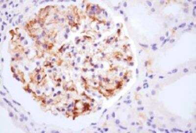 Immunohistochemistry-Paraffin: Complement C3d Antibody (053A-1149.3.1.4) - BSA Free [NB100-65510]