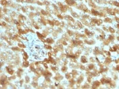 Immunohistochemistry-Paraffin: Complement C3d Antibody (C3D/2891) - Azide and BSA Free [NBP3-08764]