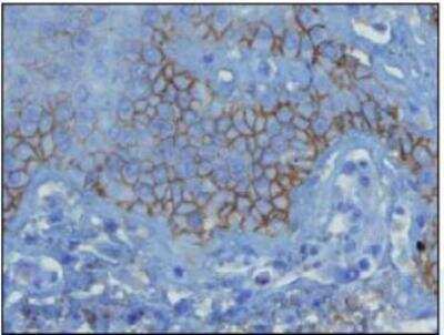 Immunohistochemistry-Paraffin: Complement C3d Antibody (E28-P) [NBP1-79074]