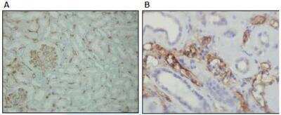 Immunohistochemistry-Paraffin: Complement C4d Antibody (A24-T) [NBP1-79075]