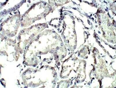 Immunohistochemistry-Paraffin: Complement C4 Antibody [NBP3-12295]
