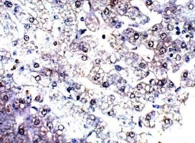 Immunohistochemistry-Paraffin: Complement C4 Antibody [NBP3-12295]