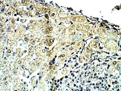 Immunohistochemistry-Paraffin: Complement C4 Antibody [NBP3-12295]