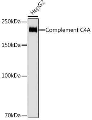 Western Blot: Complement C4a Antibody (4C3F2) [NBP3-16217]