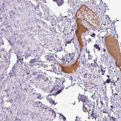 Immunohistochemistry-Paraffin: Complement C4a Antibody [NBP2-46760]