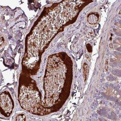 Immunohistochemistry: Complement C4a Antibody [NBP2-46783]