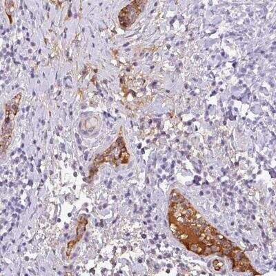 Immunohistochemistry-Paraffin: Complement C4a Antibody [NBP2-46723]