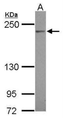 Western Blot: Complement C4a Antibody [NBP2-14893]