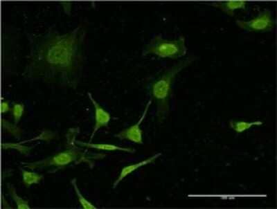 Immunocytochemistry/ Immunofluorescence: Complement C4b Antibody (1F2) [H00000721-M03]