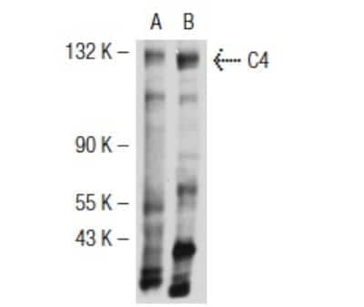 Western Blot: Complement C4b/d Antibody (16D2) [NB200-541]