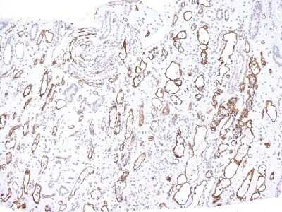 Immunohistochemistry-Paraffin: Complement C4d Antibody (C4D204) - Azide and BSA Free [NBP2-34581]