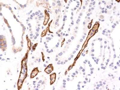 Immunohistochemistry-Paraffin: Complement C4d Antibody (C4D204) - Azide and BSA Free [NBP2-34581]