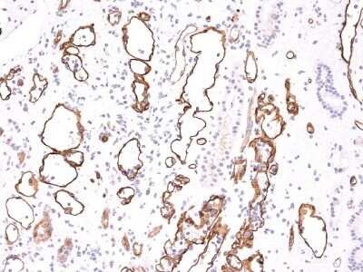 Immunohistochemistry-Paraffin: Complement C4d Antibody (C4D204) - IHC-Prediluted [NBP2-44791]