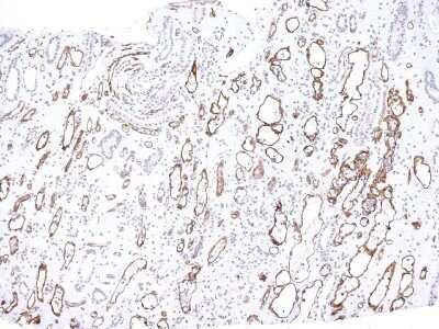 Immunohistochemistry-Paraffin: Complement C4d Antibody (C4D204) - IHC-Prediluted [NBP2-44791]