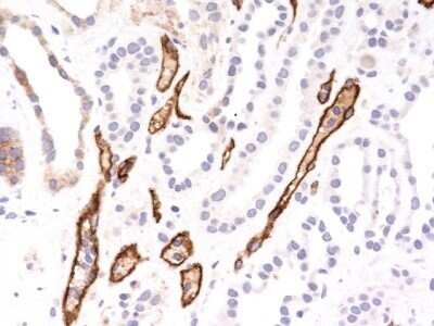 Immunohistochemistry-Paraffin: Complement C4d Antibody (C4D204) - IHC-Prediluted [NBP2-44791]