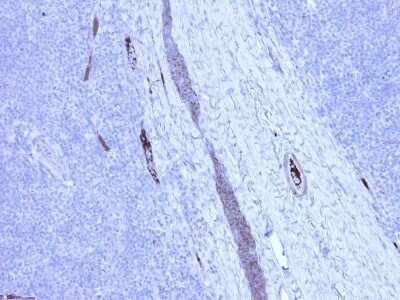 Immunohistochemistry: Complement C4c Antibody (99-72-18) - BSA Free [NBP3-12091]