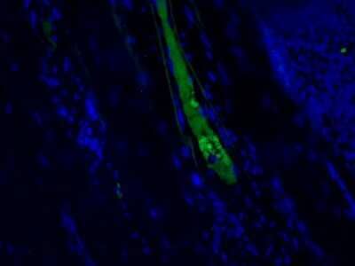 Immunohistochemistry: Complement C4c Antibody (99-72-18) - BSA Free [NBP3-12091]