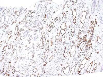 Immunohistochemistry-Paraffin: Complement C4d Antibody (C4D204) [NBP2-34234]