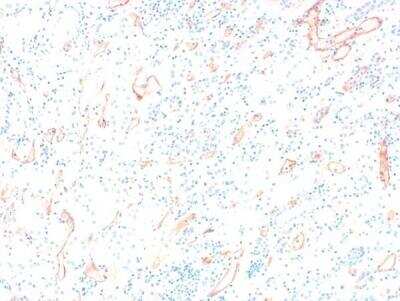 Immunohistochemistry: Complement C4d Antibody [NBP2-31130]