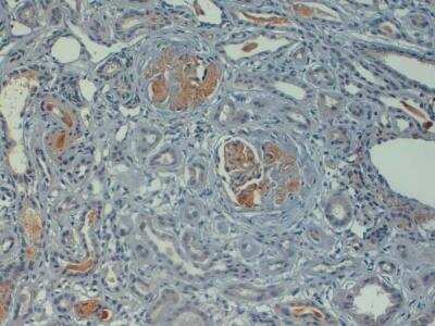 Immunohistochemistry-Paraffin: Complement C4d Antibody [NBP2-31130]