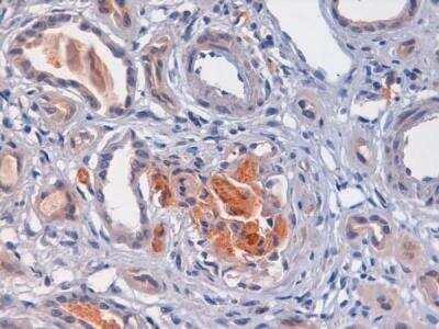 Immunohistochemistry-Paraffin: Complement C4d Antibody [NBP2-31130]