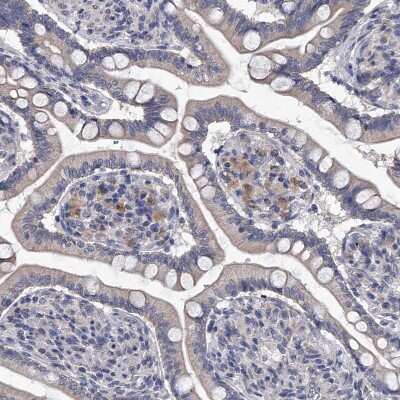 Immunohistochemistry-Paraffin: Complement C5 Antibody [NBP1-84395]