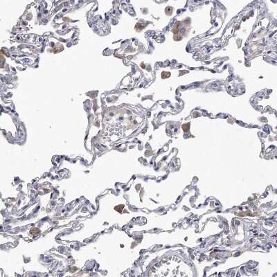 Immunohistochemistry-Paraffin: Complement C5 Antibody [NBP1-84395]