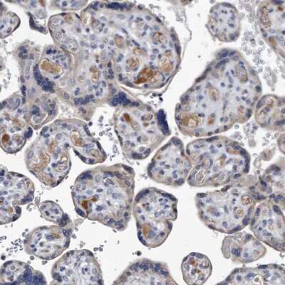 Immunohistochemistry-Paraffin: Complement C5 Antibody [NBP1-84395]