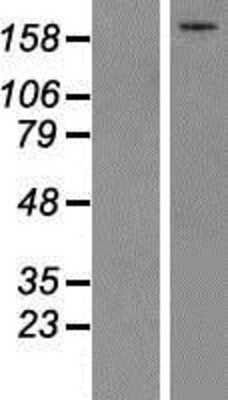 Western Blot: Complement C5 Overexpression Lysate [NBP2-10765]