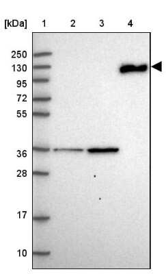 Western Blot: Complement C6 Antibody [NBP1-91803]