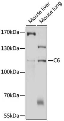 Western Blot: Complement C6 AntibodyBSA Free [NBP3-03587]