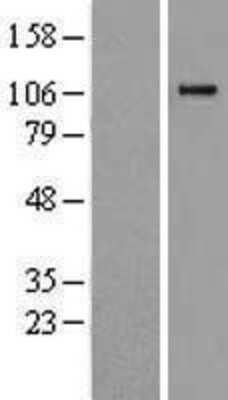 Western Blot: Complement C6 Overexpression Lysate [NBP2-11396]