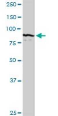 Western Blot: Complement C7 Antibody [H00000730-D01P]