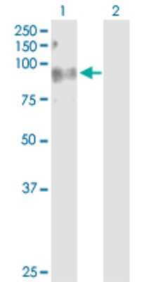 Western Blot: Complement C7 Antibody [H00000730-D01P]