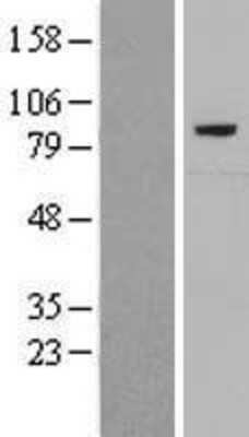 Western Blot: Complement C7 Overexpression Lysate [NBL1-08541]