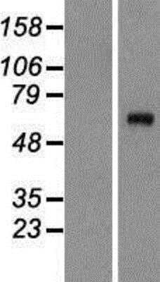 Western Blot: Complement C8A Overexpression Lysate [NBP2-09010]