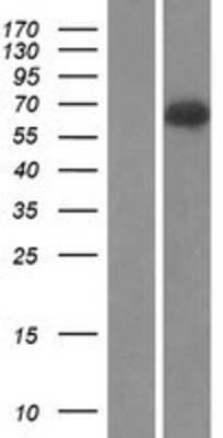 Western Blot: Complement Component C9 Overexpression Lysate [NBL1-08577]