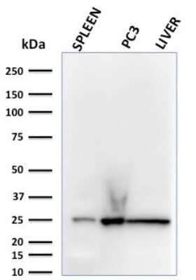 Western Blot: Complement Component C1qA Antibody (C1QA/2783) [NBP2-79781]