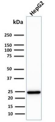 Western Blot: Complement Component C1qA Antibody (C1QA/2783) [NBP2-79781]