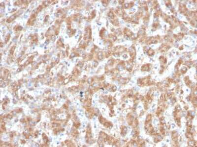 Immunohistochemistry-Paraffin: Complement Component C1qA Antibody (C1QA/2952) - Azide and BSA Free [NBP3-08746]
