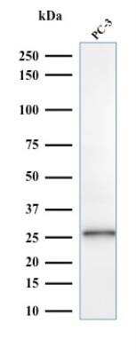 Western Blot: Complement Component C1qA Antibody (C1QA/2953)Azide and BSA Free [NBP2-79916]